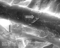 SEM image of waste fiber being degraded by microbes (Fei et al. 2013)